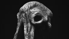 Prognostic 类似于 Prognostic